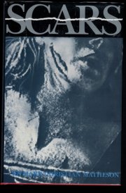 Scars and Other Distinguishing Marks cover image