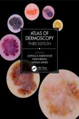 Atlas of Dermoscopy cover image