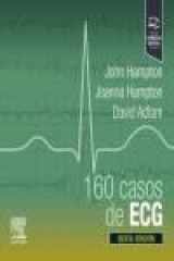 160 casos de ECG cover image