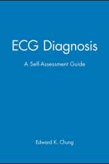 ECG Diagnosis A Self-Assessment Guide cover image
