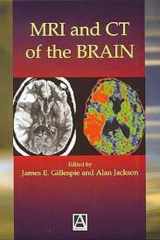 MRI and CT of the Brain cover image
