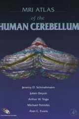 MRI Atlas of the Human Cerebellum cover image