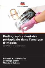 Radiographie dentaire périapicale dans l'analyse d'images (French Edition) cover image