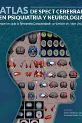 Atlas de spect cerebral en psiquiatria y neurología Importancia de la tomografía computarizada por emisión de fotón único cover image