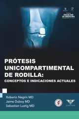 Prótesis unicompartimental de rodilla: Conceptos e indicaciones actuales (Spanish Edition) cover image