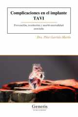 Complicaciones en el implante TAVI: Prevención, resolución y morbi-mortalidad asociada (Spanish Edition) cover image