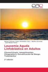 Leucemia Aguda Linfoblástica en Adultos (Spanish Edition) cover image