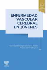Enfermedad vascular cerebral en jóvenes cover image