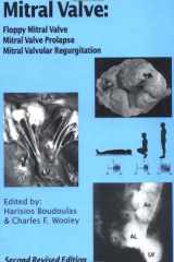 Mitral Valve Floppy Mitral Valve, Mitral Valve Prolapse, Mitral Valvular Regurgitation cover image