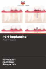 Péri-implantite: Percer le mystère (French Edition) cover image