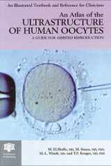 An Atlas of the Ultrastructure of Human Oocytes A Guide for Assisted Reproduction cover image