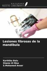 Lesiones fibrosas de la mandíbula (Spanish Edition) cover image