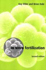 In Vitro Fertilization cover image