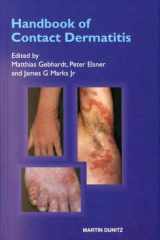 Handbook of Contact Dermatitis cover image