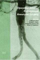 Operative Atlas of Endoluminal Aneurysm Surgery cover image