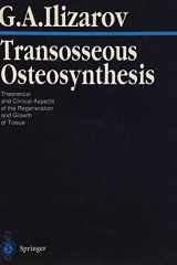 Transosseous Osteosynthesis Theoretical and Clinical Aspects of the Regeneration and Growth of Tissue cover image