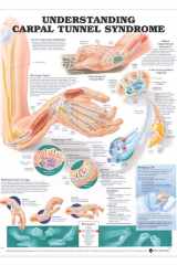 Understanding Carpal Tunnel Syndrome Anatomical Chart cover image