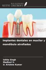 Implantes dentales en maxilar y mandíbula atrofiados (Spanish Edition) cover image