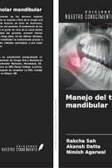 Manejo del tercer molar mandibular (Spanish Edition) cover image