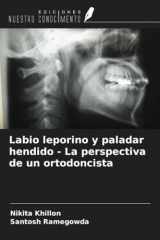 Labio leporino y paladar hendido - La perspectiva de un ortodoncista (Spanish Edition) cover image