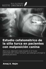 Estudio cefalométrico de la silla turca en pacientes con malposición canina (Spanish Edition) cover image