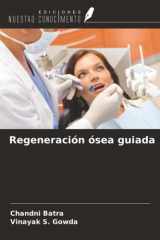 Regeneración ósea guiada (Spanish Edition) cover image