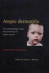 Atopic dermatitis: the epidemiology, causes, and prevention of atopic eczema cover image