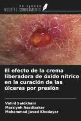 El efecto de la crema liberadora de óxido nítrico en la curación de las úlceras por presión (Spanish Edition) cover image