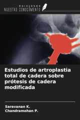 Estudios de artroplastia total de cadera sobre prótesis de cadera modificada (Spanish Edition) cover image