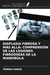 DISPLASIA FIBROSA Y MÁS ALLÁ: COMPRENSIÓN DE LAS LESIONES FIBROÓSEAS DE LA MANDÍBULA (Spanish Edition) cover image