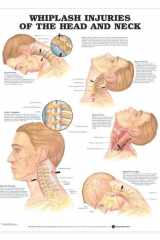 Whiplash Injuries of the Head and Neck cover image