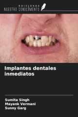 Implantes dentales inmediatos (Spanish Edition) cover image