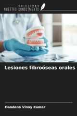 Lesiones fibroóseas orales (Spanish Edition) cover image