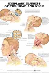 Whiplash Injuries of the Head and Neck Anatomical Chart cover image