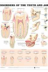 Disorders of the Teeth and Jaw Anatomical Chart cover image
