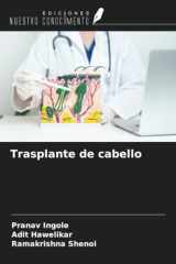 Trasplante de cabello (Spanish Edition) cover image