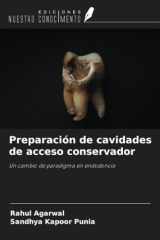 Preparación de cavidades de acceso conservador: Un cambio de paradigma en endodoncia (Spanish Edition) cover image