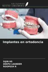 Implantes en ortodoncia (Spanish Edition) cover image