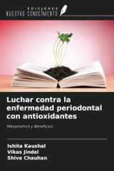 Luchar contra la enfermedad periodontal con antioxidantes: Mecanismos y Beneficios (Spanish Edition) cover image