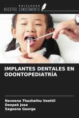IMPLANTES DENTALES EN ODONTOPEDIATRÍA (Spanish Edition) cover image