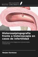 Histerosalpingografía frente a histeroscopia en casos de infertilidad: Rendimiento en el diagnóstico de anomalías intrauterinas (Spanish Edition) cover image