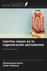 Injertos óseos en la regeneración periodontal: Una visión general (Spanish Edition) cover image