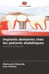 Implants dentaires chez les patients diabétiques: Concepts et considérations (French Edition) cover image