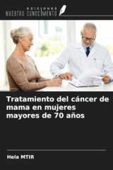 Tratamiento del cáncer de mama en mujeres mayores de 70 años (Spanish Edition) cover image