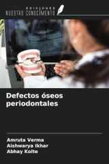 Defectos óseos periodontales (Spanish Edition) cover image
