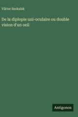 De la diplopie uni-oculaire ou double vision d'un oeil cover image